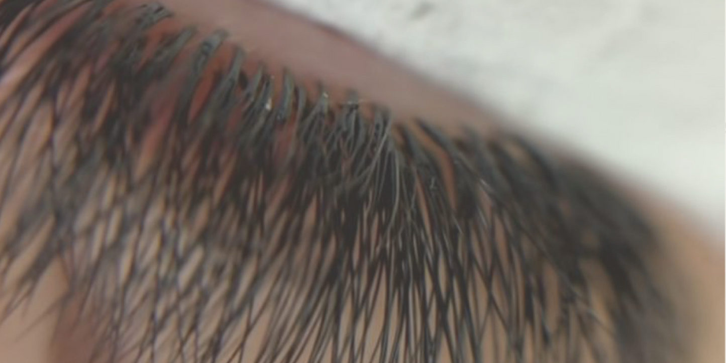 Eyelash Extensions